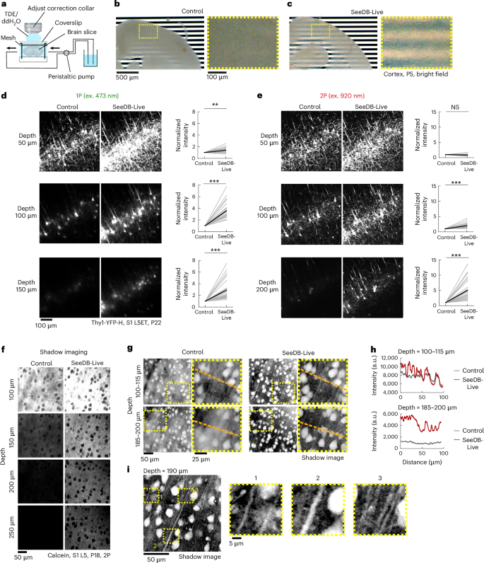 Fig. 2: Improved morphological imaging of acute brain slices with SeeDB-Live.