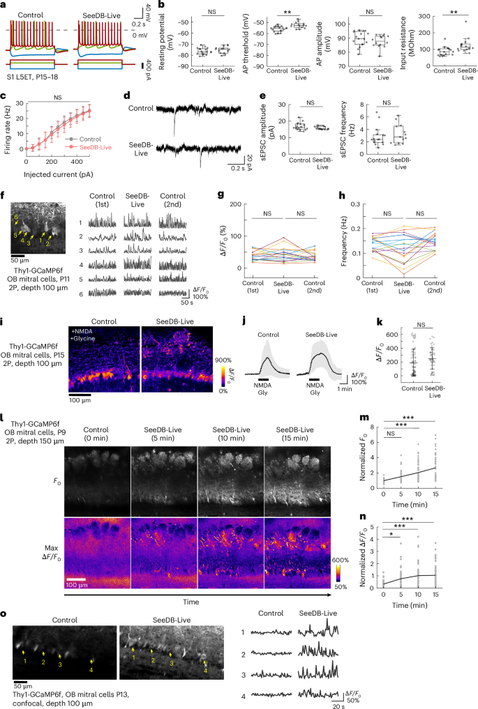 Fig. 3: Electrophysiological recording and calcium imaging of neurons in acute brain slices.