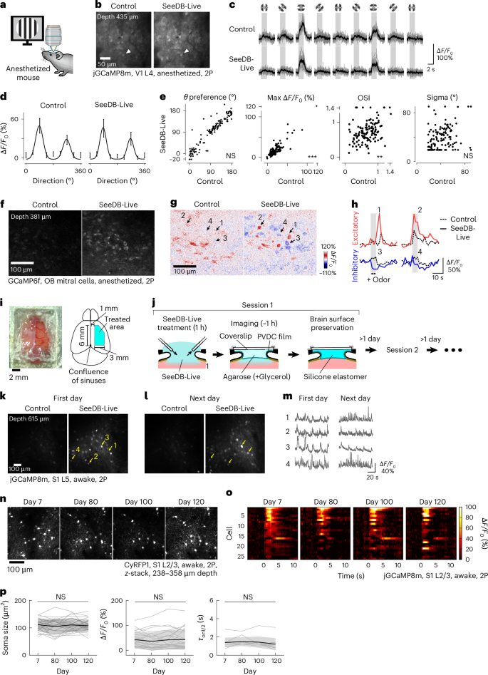 Fig. 5: Improved in vivo imaging of neuronal activity with SeeDB-Live.