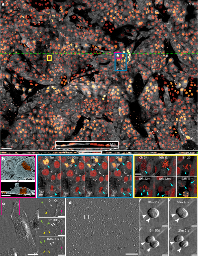 Fig. 1: Large field-of-view dynamic imaging with 3D lattice light-sheet or 2D label-free oblique illumination microscopy.