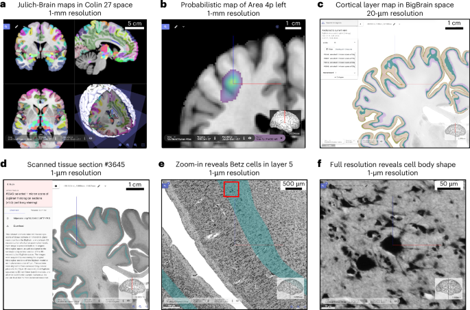 Fig. 2: Visually guided exploration of brain structure from the whole brain down to individual cells with siibra-explorer.