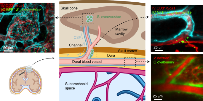 Cerebrospinal fluid can exit into the skull bone marrow and ...