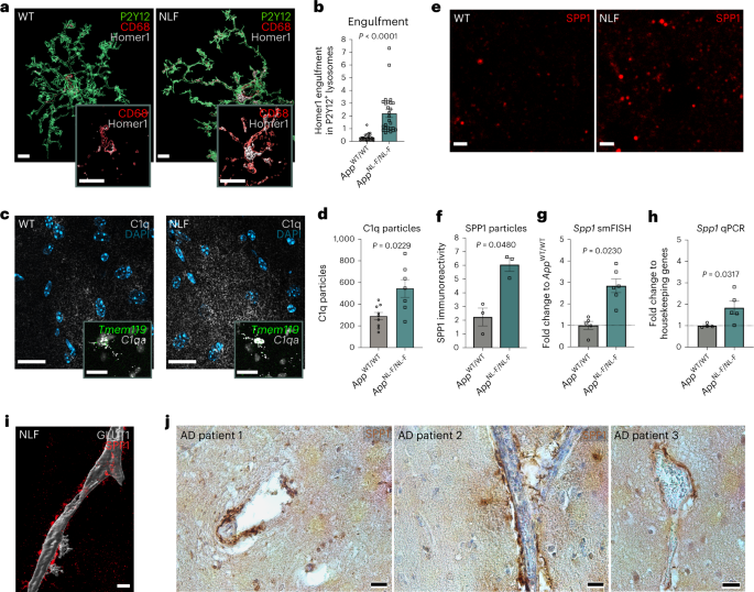 Fig. 1: SPP1 upregulation at onset of microglia–synapse phagocytosis.