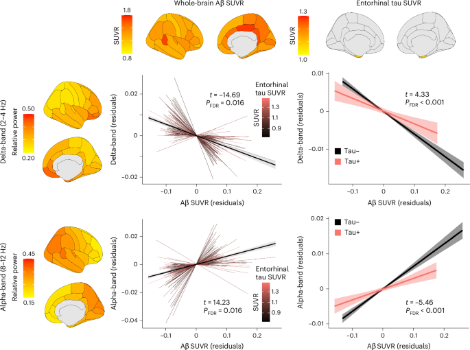 Fig. 3: Interactive effects of AD proteinopathies on neurophysiological activity in asymptomatic adults.