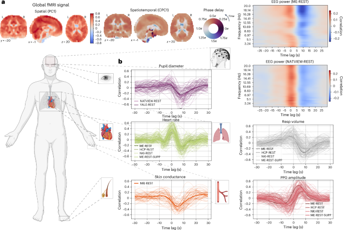 Autonomic physiological coupling of the global fMRI signal | Nature ...