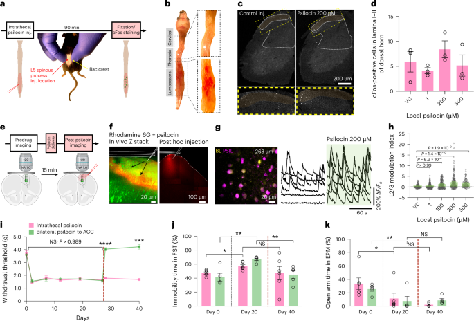 Fig. 4: Local application of psilocin to the ACC reverses SNI-induced mechanical allodynia and anxiodepressive-like behaviors.