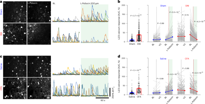 Fig. 5: Local psilocin normalizes the spontaneous hyperactivity of pyramidal neurons in both neuropathic and inflammatory pain states.