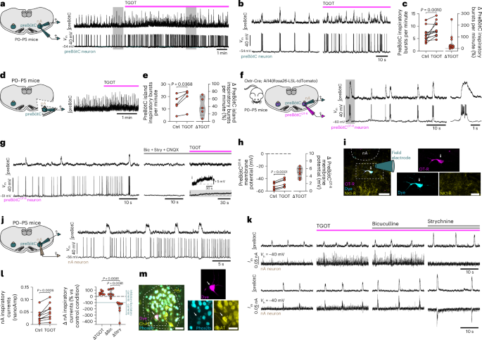 Fig. 5: TGOT increases the frequency of preBötC inspiratory bursts, depolarizes preBötCOT-R neurons that are inspiratory bursting and amplifies the glycinergic post-synaptic currents occurring in nA neurons during inspiratory bursts in rhythmic slices in vitro.