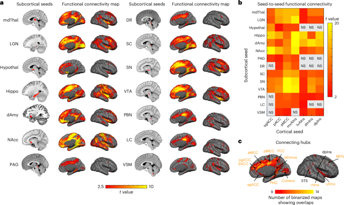 Fig. 4: Subcortico-cortical intrinsic connectivity within the allostatic–interoceptive system.