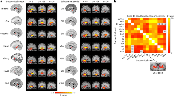 Fig. 6: Subcortico-subcortical intrinsic connectivity within the allostatic–interoceptive system.