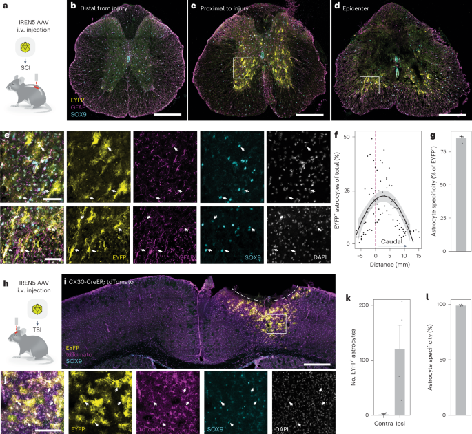 Fig. 6: IREN5 AAV targets reactive astrocytes across the CNS.