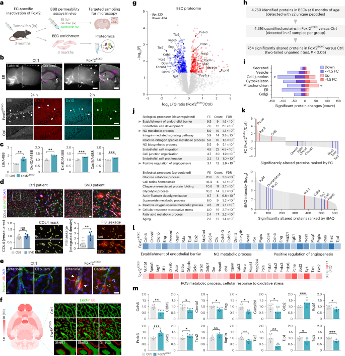 Fig. 2: Endothelial Foxf2 deficiency causes BBB leakage and attenuates Tie2 signaling.