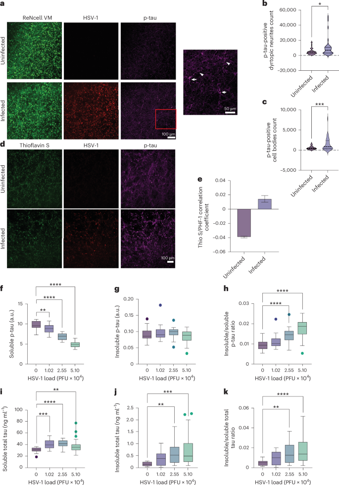Fig. 4: HSV-1 induces intraneuronal aggregation of p-tau and neuritic dystrophy.