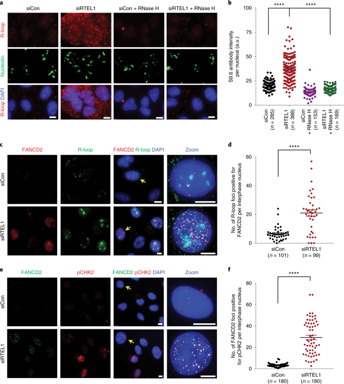 Rtel1 Suppresses G Quadruplex Associated R Loops At Difficult To Replicate Loci In The Human Genome Nature Structural Molecular Biology