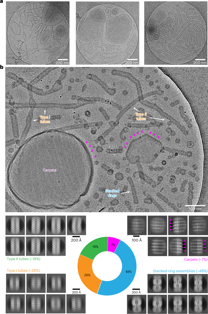 Fig. 1: Multitude of different Vipp1 structures after membrane incubation.