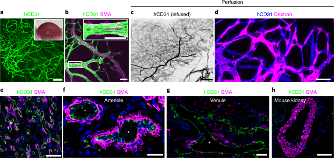 Generation Of Blood Vessel Organoids From Human Pluripotent Stem Cells Nature Protocols