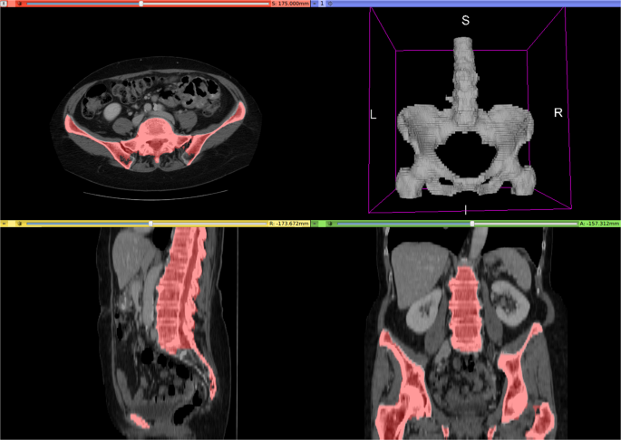 figure2