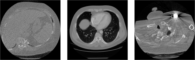 Lodopab Ct A Benchmark Dataset For Low Dose Computed Tomography Reconstruction Scientific Data