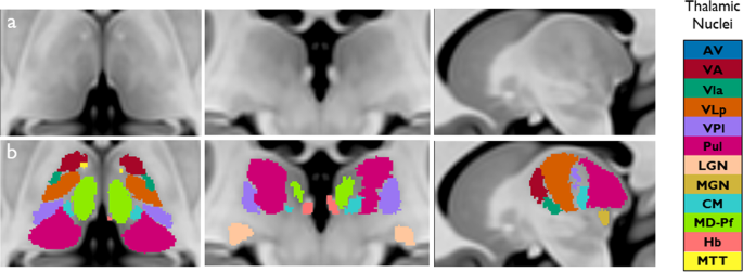 In vivo high-resolution structural MRI-based atlas of human thalamic nuclei  | Scientific Data