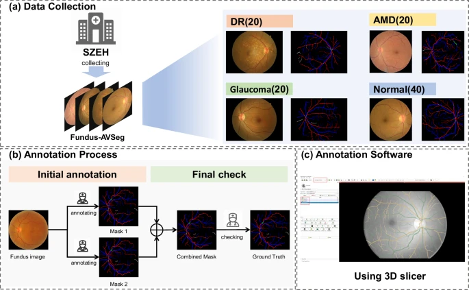 A diagram illustrating the workflow for creating the Fundus-AVSeg dataset, from data collection to the multi-stage annotation process.