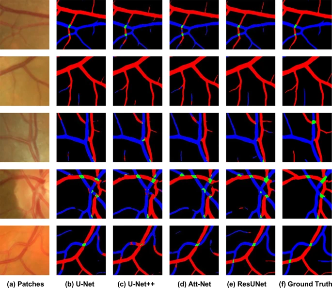 A visual comparison of segmentation results from different AI models, highlighting arteries, veins, and crossings.