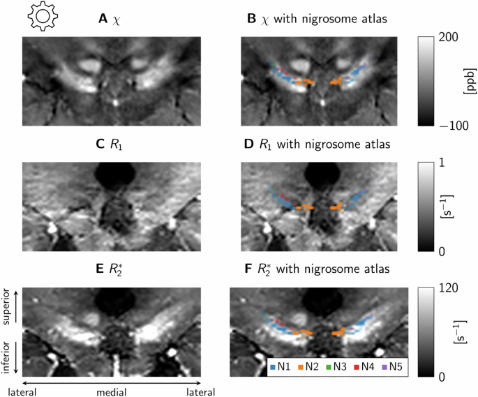 Fig. 10