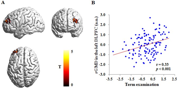 Poverty Linked To Brain Structure In >> Examining Gray Matter Structure Associated With Academic Performance Poverty Linked To Brain Structure In >> Examining Gray Matter Structure Associated With Academic Performance