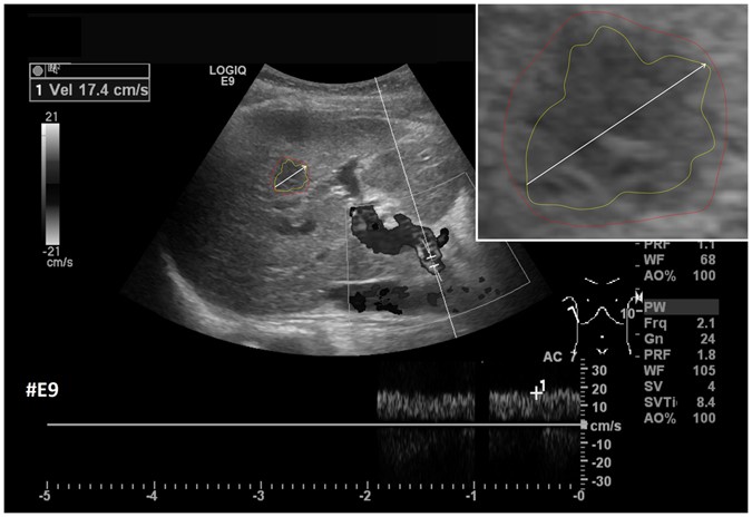 figure 12