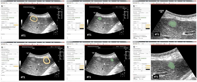 figure 14