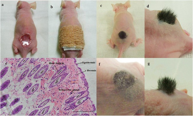 As a carrier–transporter for hair follicle reconstitution, platelet-rich  plasma promotes proliferation and induction of mouse dermal papilla cells |  Scientific Reports