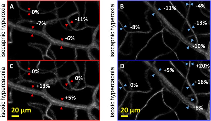 Frontiers  Retinal Vessel Responses to Flicker Stimulation Are