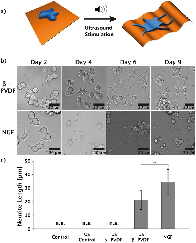 Ultrasound Mediated Piezoelectric Differentiation Of Neuron Like Pc12 Cells On Pvdf Membranes Scientific Reports Ultrasound Mediated Piezoelectric Differentiation Of Neuron Like Pc12 Cells On Pvdf Membranes Scientific Reports