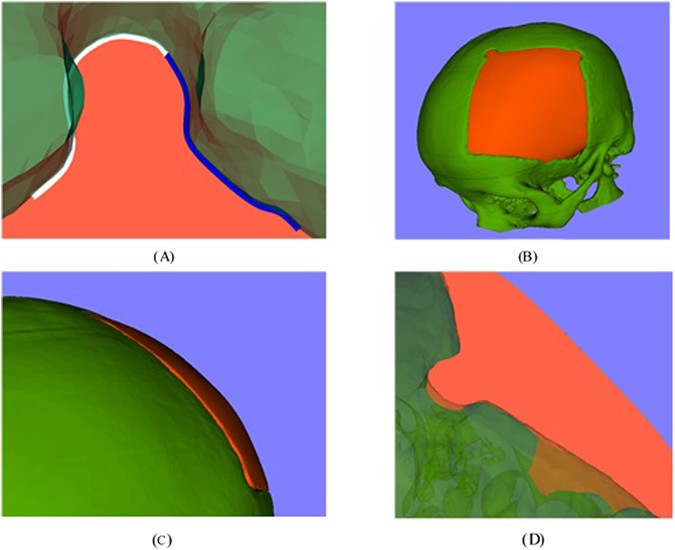 figure 12