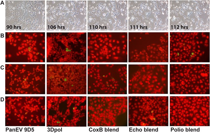 Revealing enterovirus infection in chronic human disorders: An integrated  diagnostic approach | Scientific Reports