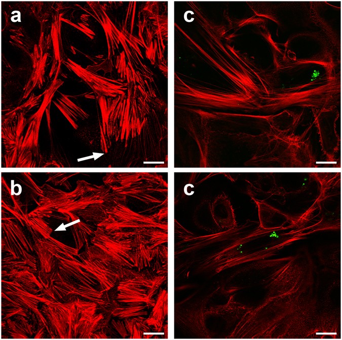 Differentiating Staphylococcus Aureus From Escherichia Coli Mastitis S Aureus Triggers Unbalanced Immune Dampening And Host Cell Invasion Immediately After Udder Infection Scientific Reports