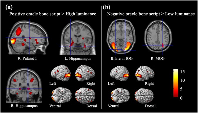 EvSys: A Relational Dynamic System for Sparse Irregular Clinical Events