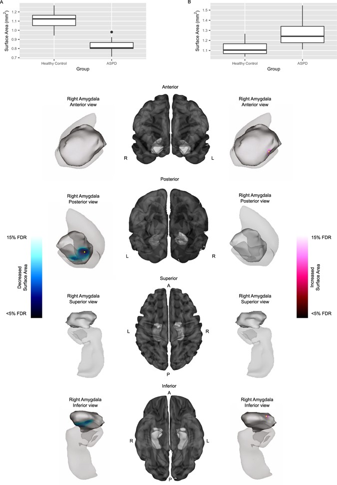 Association of monoamine oxidase-A genetic variants and amygdala morphology  in violent offenders with antisocial personality disorder and high  psychopathic traits | Scientific Reports