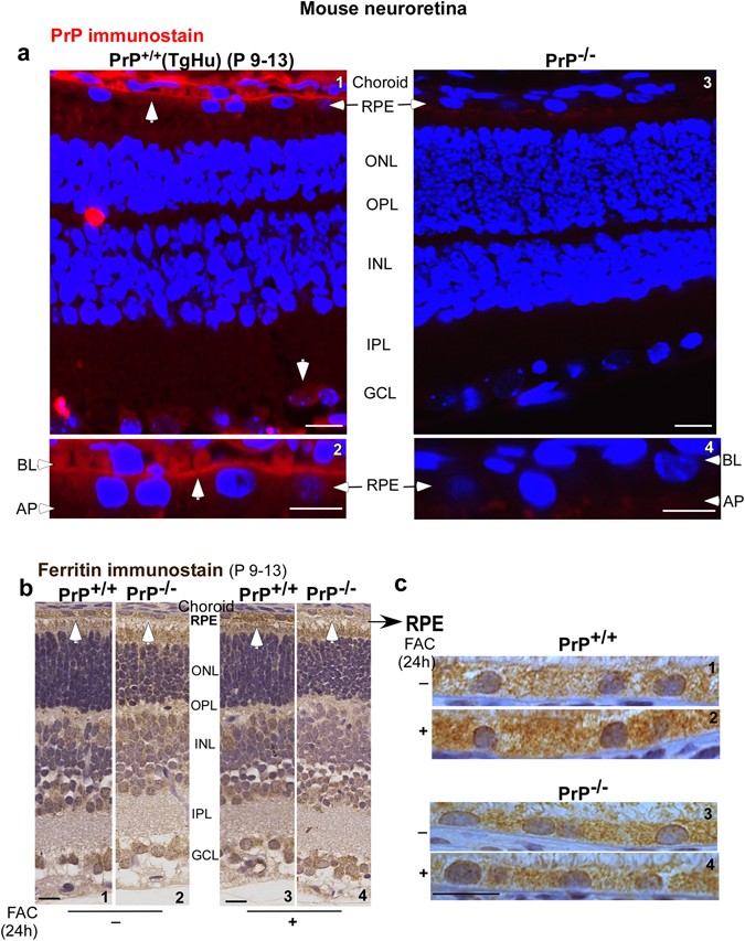 Prion Protein Facilitates Retinal Iron Uptake And Is Cleaved At The B Site Implications For Retinal Iron Homeostasis In Prion Disorders Scientific Reports