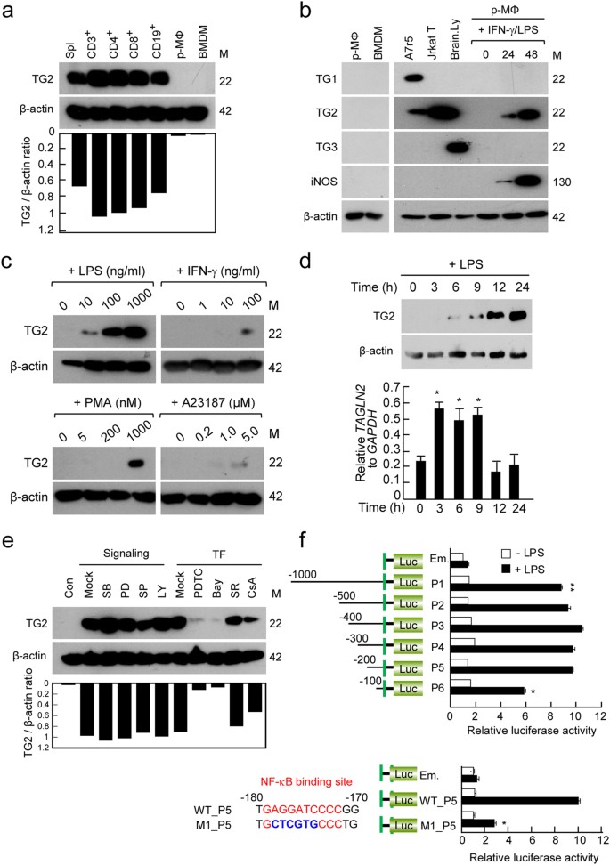 An Essential Role for TAGLN2 in Phagocytosis of  Lipopolysaccharide-activated Macrophages | Scientific Reports