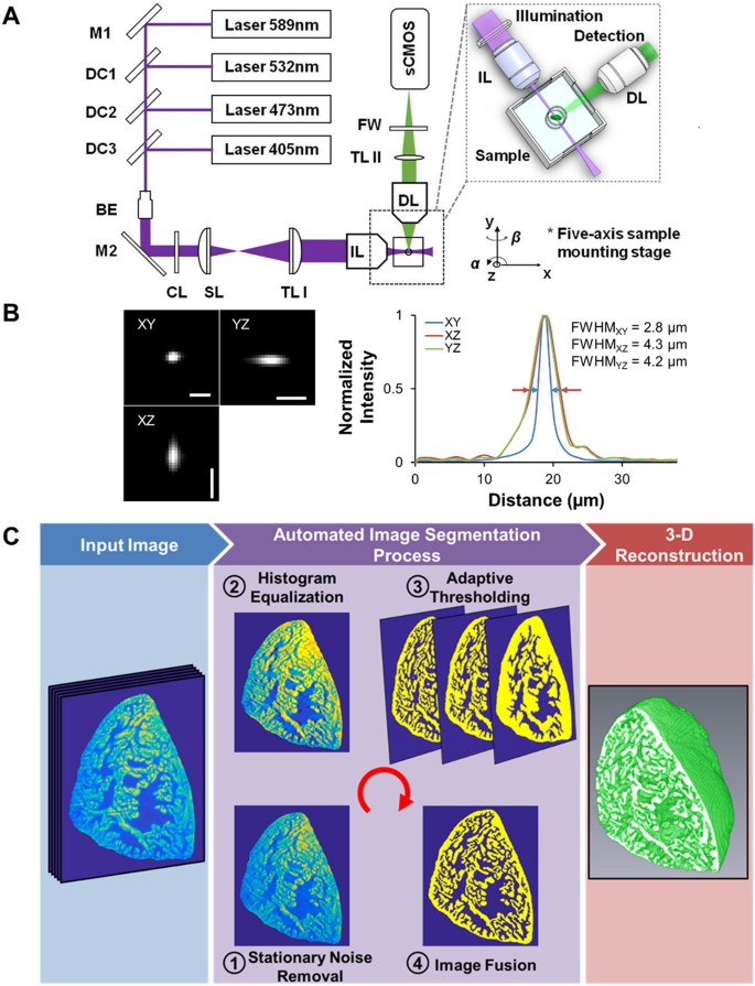 Automated Segmentation of Light-Sheet Fluorescent Imaging to Characterize  Experimental Doxorubicin-Induced Cardiac Injury and Repair | Scientific  Reports