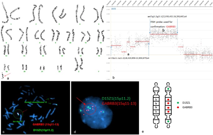 Molecular characterization of 20 small supernumerary marker chromosome  cases using array comparative genomic hybridization and fluorescence in  situ hybridization | Scientific Reports