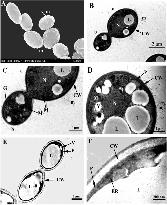 Reversible naftifine-induced carotenoid depigmentation in Rhodotorula  mucilaginosa (A. Jörg.) . Harrison causing onychomycosis | Scientific  Reports