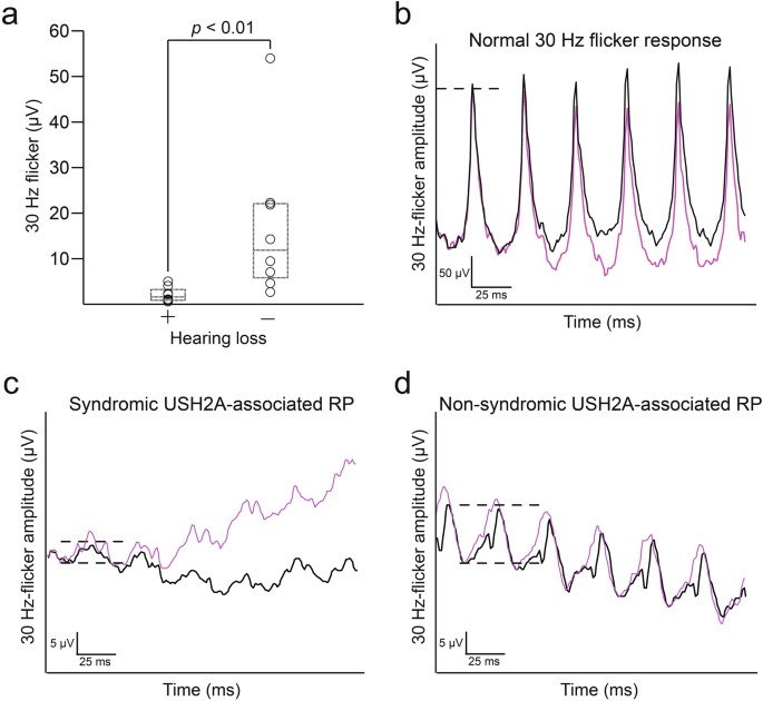 Reduced rod electroretinograms in carrier parents of two Japanese