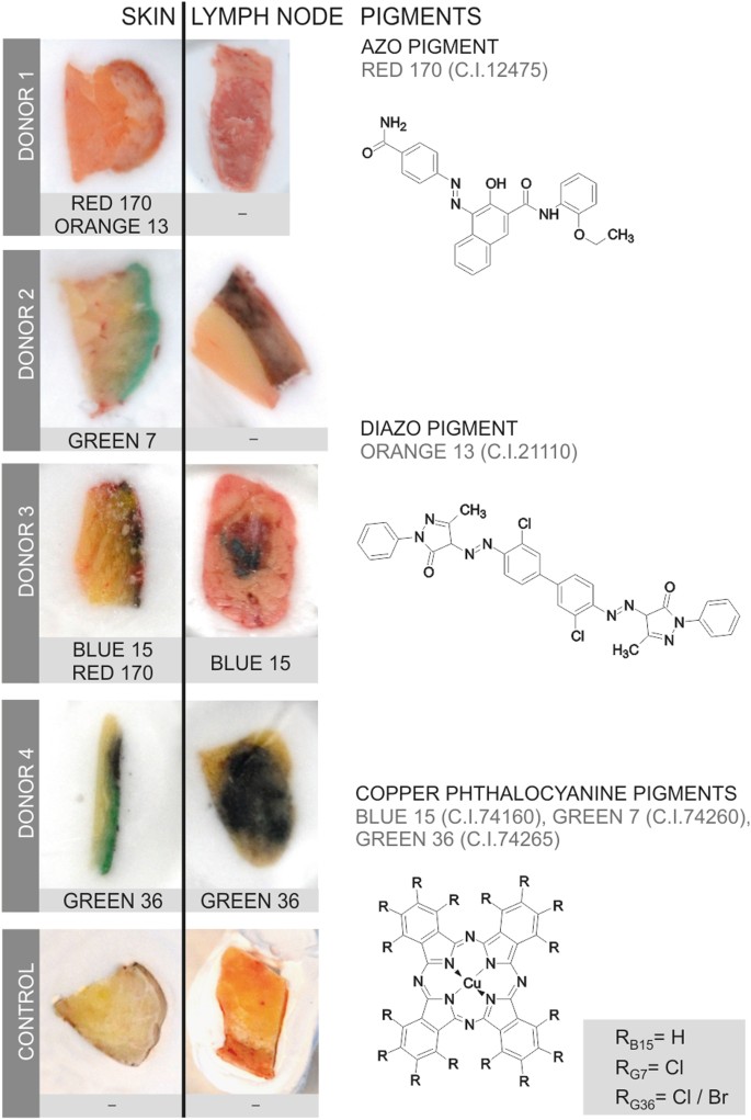 figure2