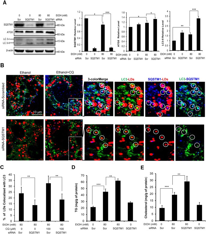 SQSTM1, Ethanol-triggered Lipophagy Requires SQSTM1 in AML12 Hepatic Cells