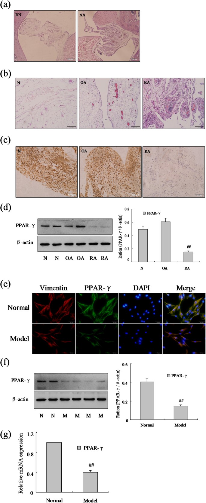 Functional Role Of Ppar G On The Proliferation And Migration Of Fibroblast Like Synoviocytes In Rheumatoid Arthritis Scientific Reports Functional Role Of Ppar G On The Proliferation And Migration Of Fibroblast Like Synoviocytes In Rheumatoid Arthritis Scientific Reports