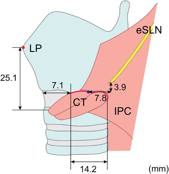 Surgical anatomy of the external branch of the superior laryngeal