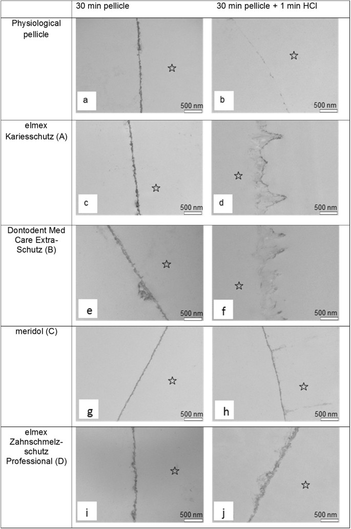 Impact Of Customary Fluoride Rinsing Solutions On The Pellicle S Protective Properties And Bioadhesion In Situ Scientific Reports