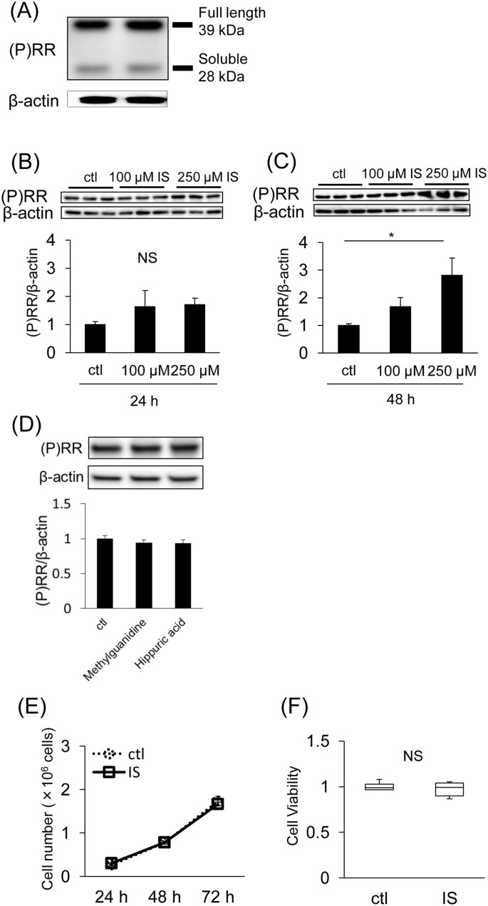 Pro Renin Receptor Is Involved In Mesangial Fibrosis And Matrix Expansion Scientific Reports