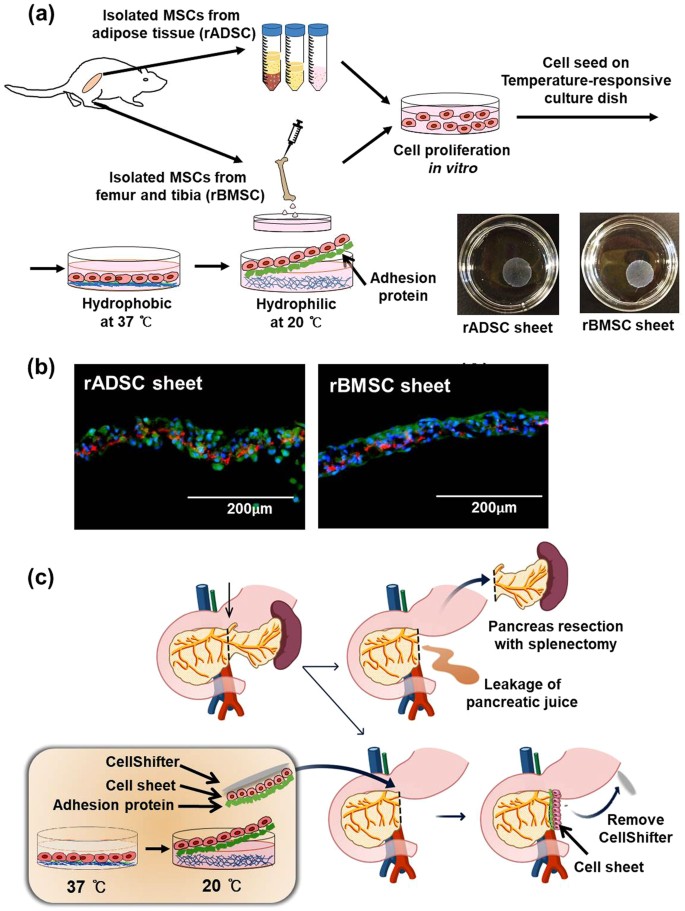 Asan Statement On Media Claims Linking >> Engineered Mesenchymal Stem Cell Sheets Patches Prevents Asan Statement On Media Claims Linking >> Engineered Mesenchymal Stem Cell Sheets Patches Prevents